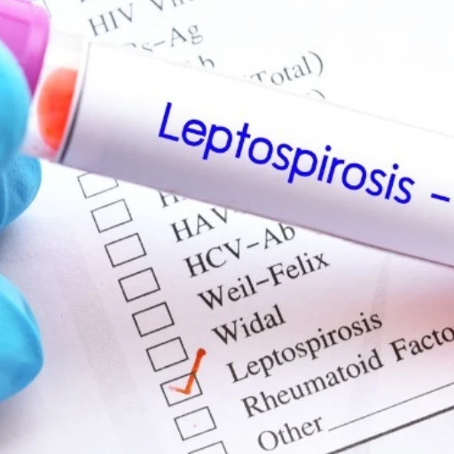 Perú reporta nueve fallecidos y más de 1.200 casos de leptospirosis